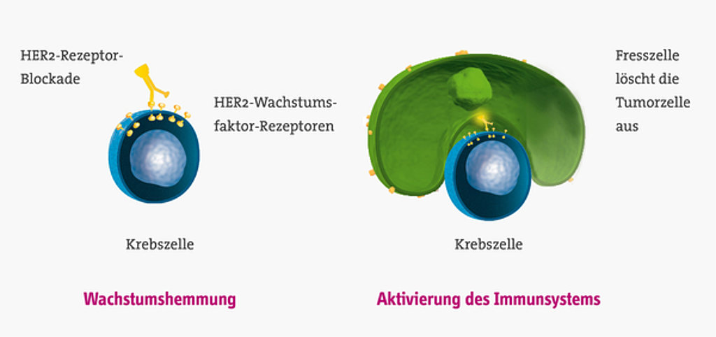 Antikörpertherapie Bei Brustkrebs | Das K Wort