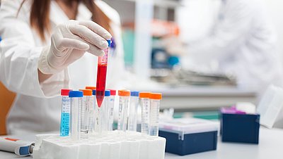Eine Hand im medizinischen Handschuh hält eine Blutprobe im Labor