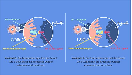 Schematische Darstellung der Wirkungsweise der Immuntherapie bei Krebs.