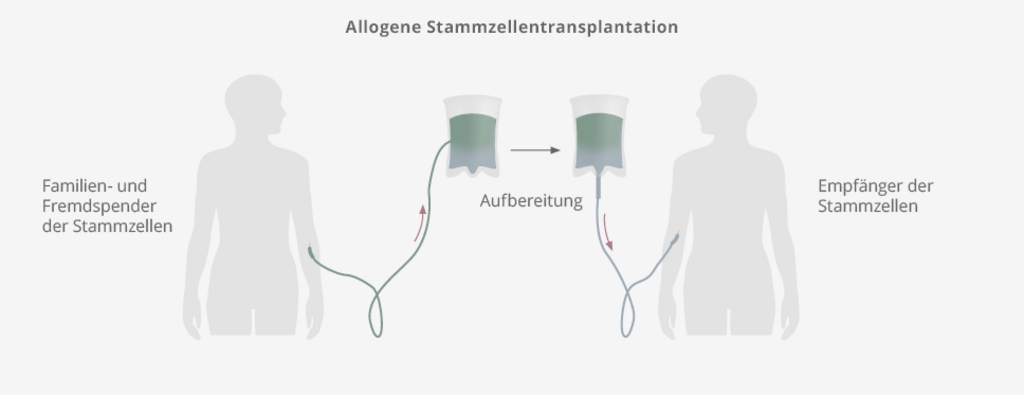 Stammzelltransplantation beim DLBCL | Das K Wort