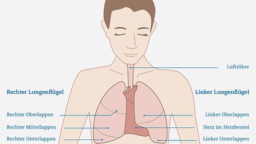 Schematische Darstellung zur Aufteilung der Lungenflügel