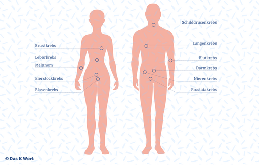 Grafische Darstellung von Krebsarten, die mit Immuntherapie behandelt werden können