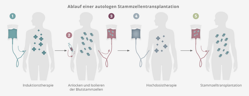 Ablauf einer autologen Stammzelltransplantation: die Patientin oder der Patient bekommt die eigenen Stammzellen zurück 