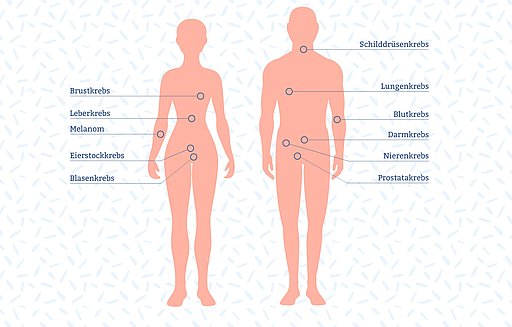 Grafische Darstellung von Krebsarten, die mit Immuntherapie behandelt werden können