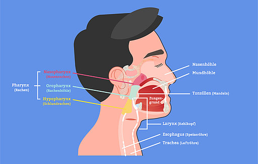 Grafik von Kopf und Hals, wo Tumore auftreten können